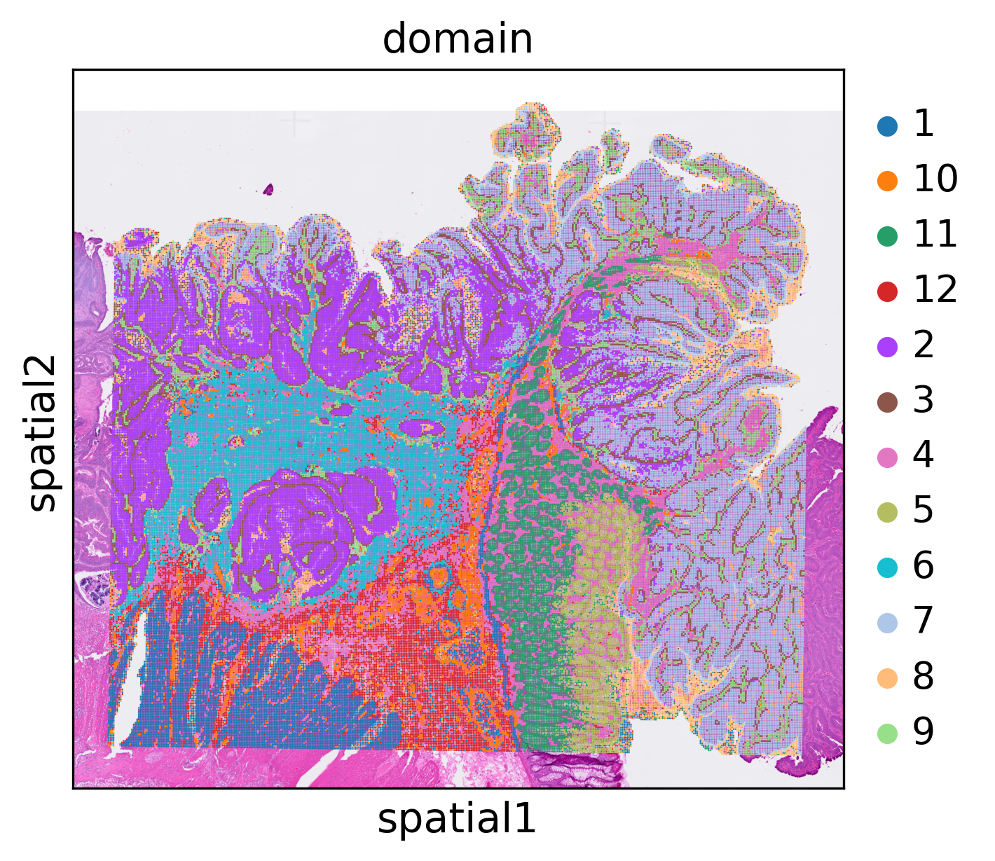 ../_images/notebooks_human_colorectal_cancer_21_0.png