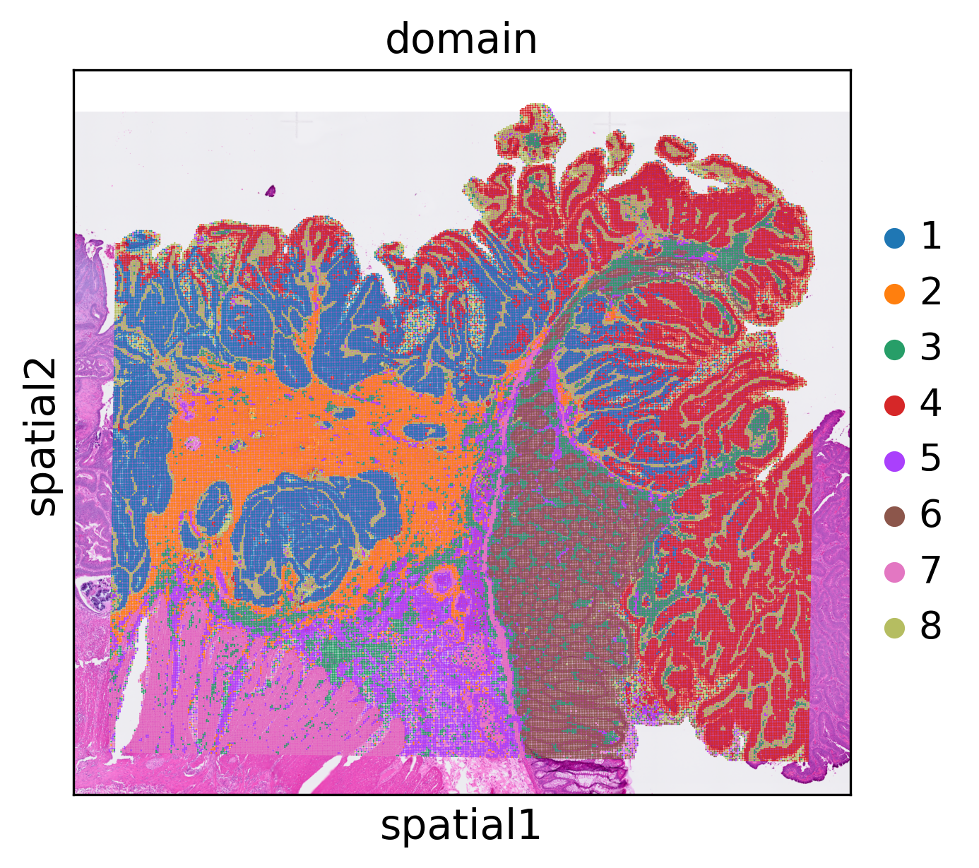 ../_images/notebooks_human_colorectal_cancer_22_1.png