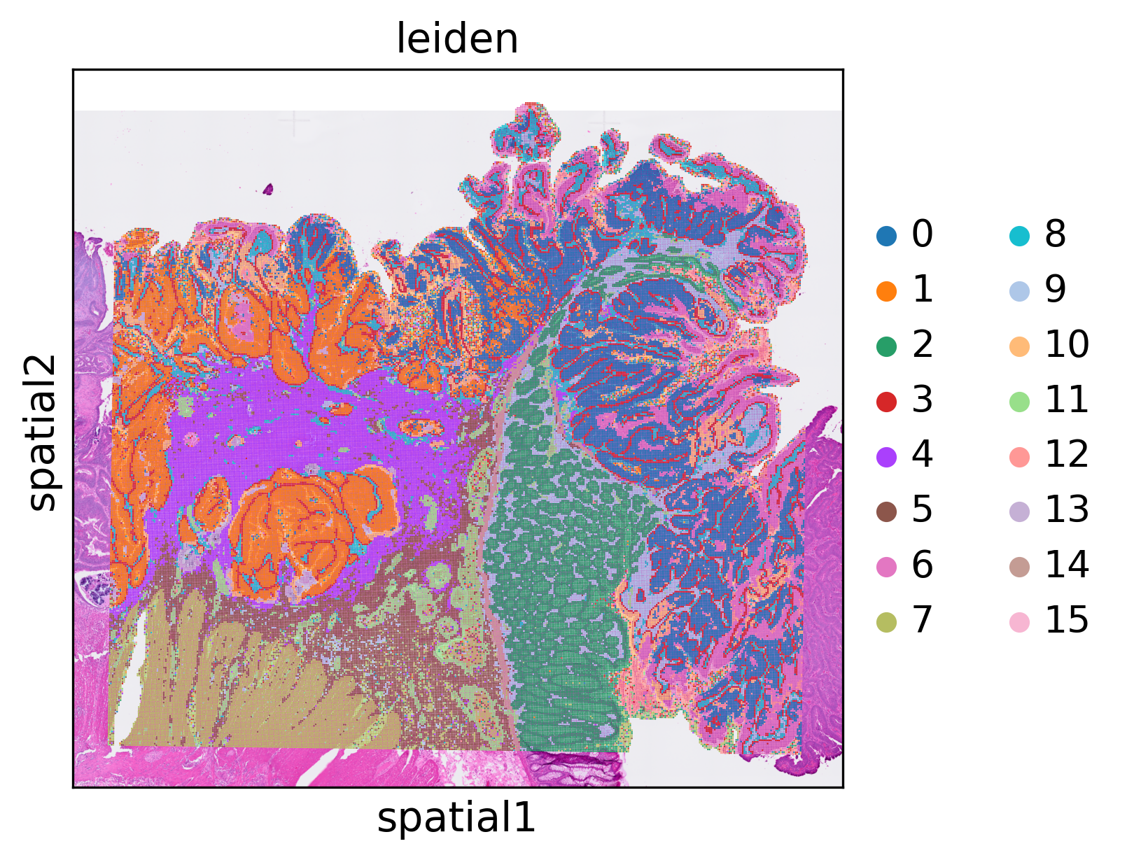 ../_images/notebooks_human_colorectal_cancer_8_0.png